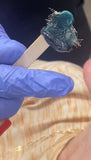 Hair Removal Services