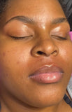Hair Removal Services