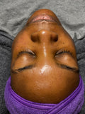 Facial