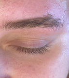 Hair Removal