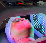 Microdermabrasion