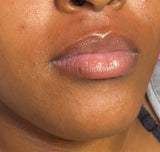 Hair Removal Services