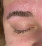 Hair Removal