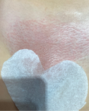 Hair Removal